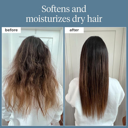 Scalp Revival Rosemary Pre-Wash Oil, Hair and Scalp, Dry Scalp Treatment for Stronger and Longer Hair, Soothe Dry Scalp, Lipids and Vitamins, Deep Moisture, Vegan, Cruelty-Free, 3.4 Fl Oz