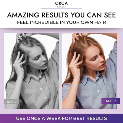Biotin Shampoo and Conditioner for Women and Men - Volumizing Shampoo and Conditioner Set to Help Boost Thinning Hair - Hydrating, Nourishing Hair Loss Shampoo and Conditioner