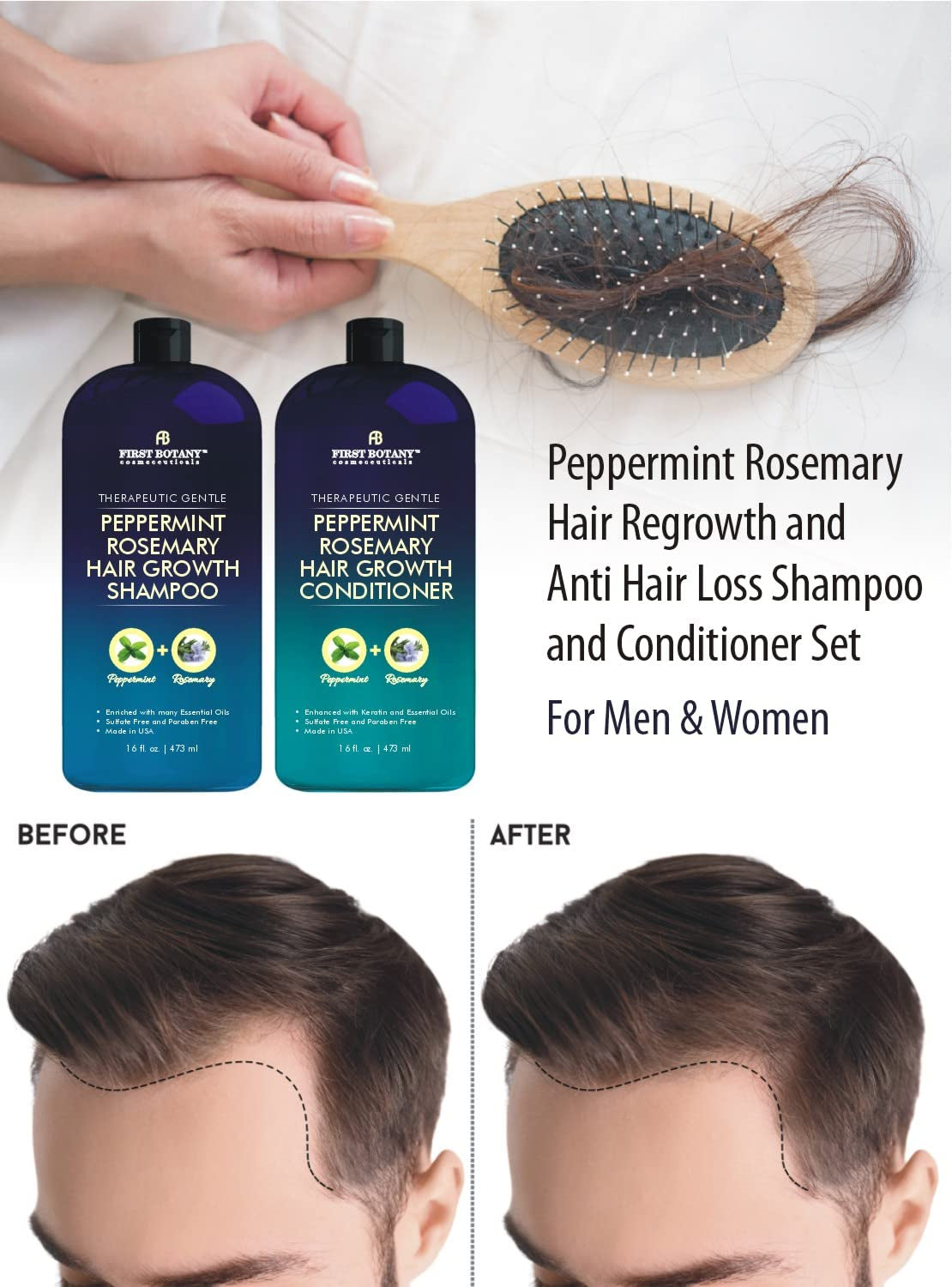 , Peppermint Rosemary Hair Regrowth and anti Hair Loss Shampoo and Conditioner Set - Daily Hydrating, Detoxifying, Volumizing Shampoo and Fights Dandruff for Men and Women 16 Fl Oz X 2